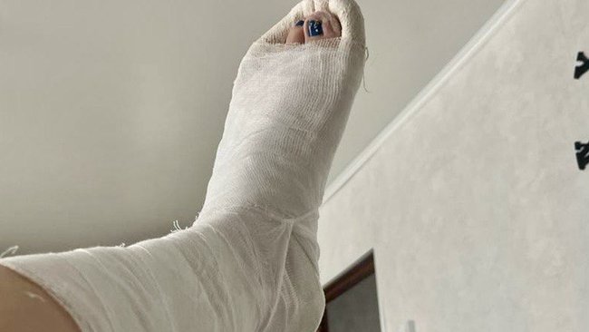 Сольилечанка взыскала компенсацию морального вреда за перелом ноги